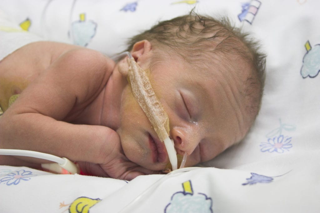 close up of a hospitalized baby with an oxygen tube