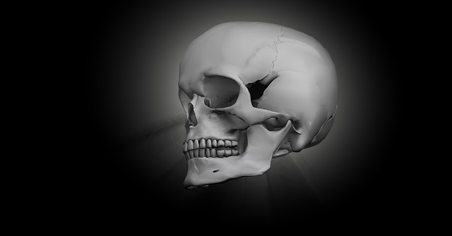 Broken skull